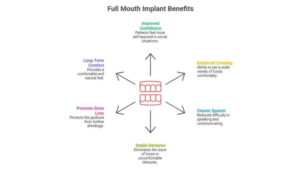 Benefits of Full Mouth Dental Implants in Rajajinagar