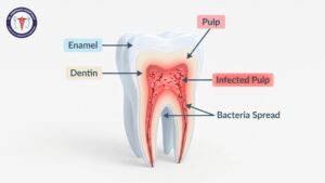 affordable root canal treatment in rajajinagar