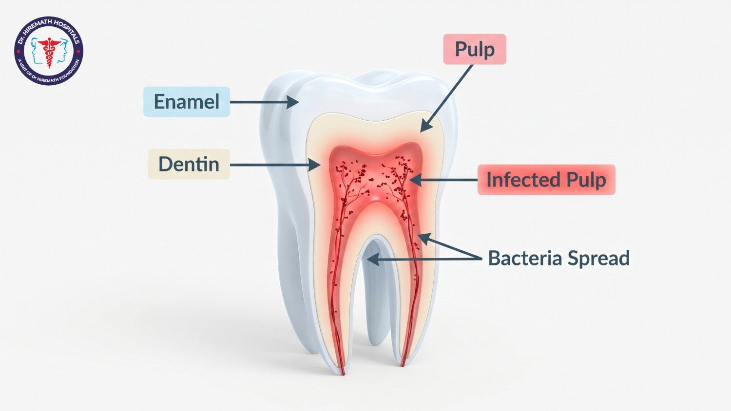 affordable root canal treatment in rajajinagar