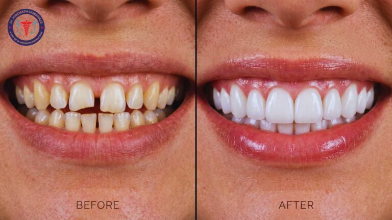 smile design in rajajinagar