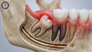oral surgery in rajajinagar